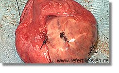 Steroide nebenwirkungen bilder